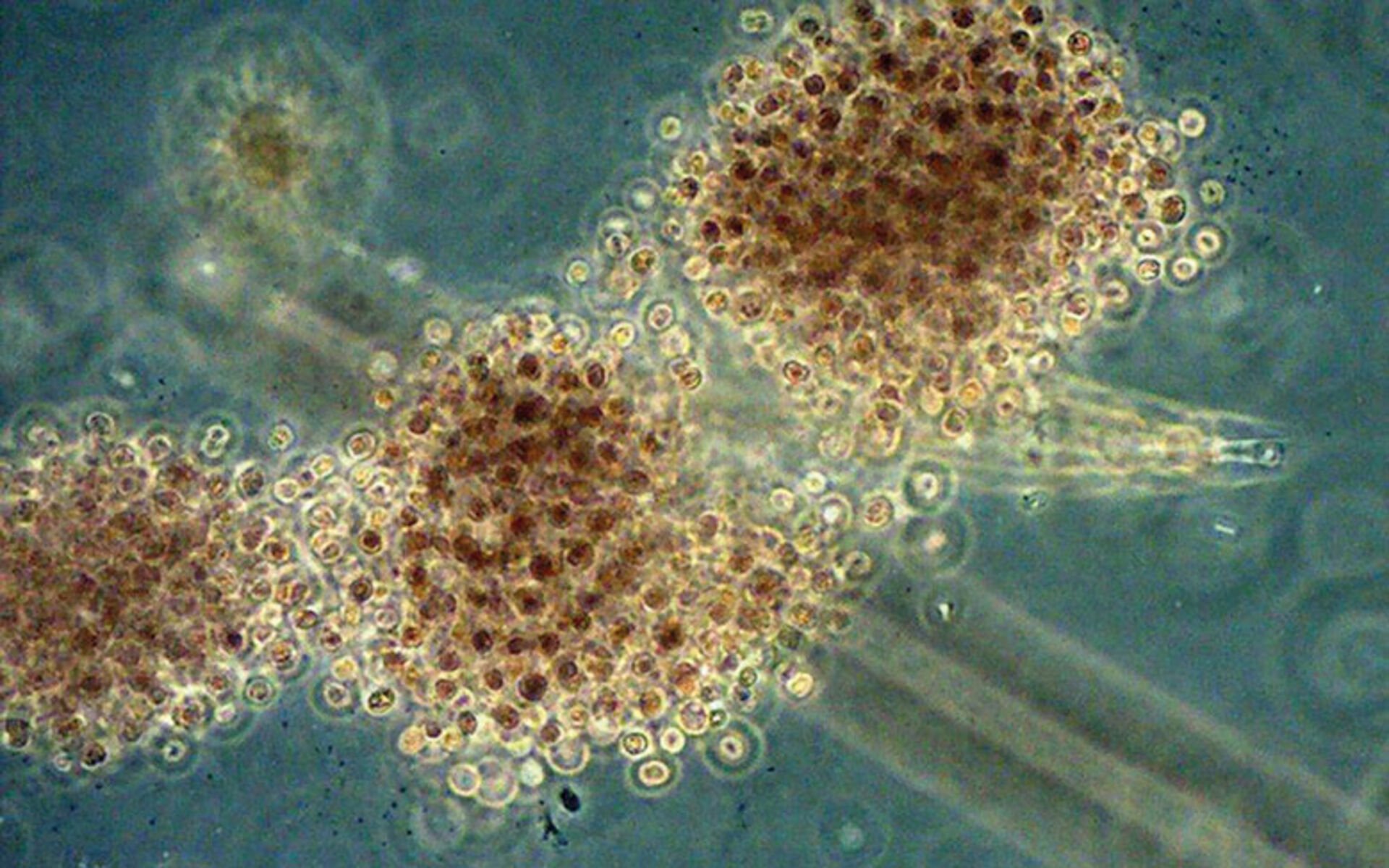  «Schöner» sehen die Cyanobakterien unter dem Mikroskop aus. Es gibt tausende unterschiedliche Arten und nur ein Teil von ihnen enthält Giftstoffe. © EAWAG  