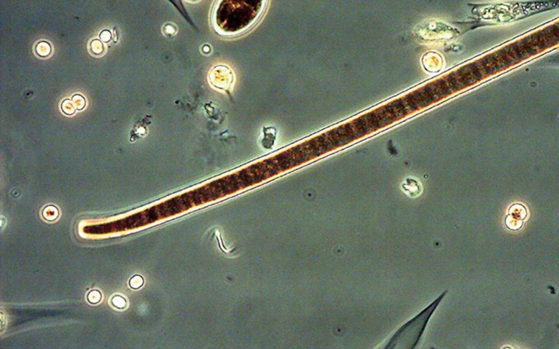  «Schöner» sehen die Cyanobakterien unter dem Mikroskop aus. Es gibt tausende unterschiedliche Arten und nur ein Teil von ihnen enthält Giftstoffe. © EAWAG  
