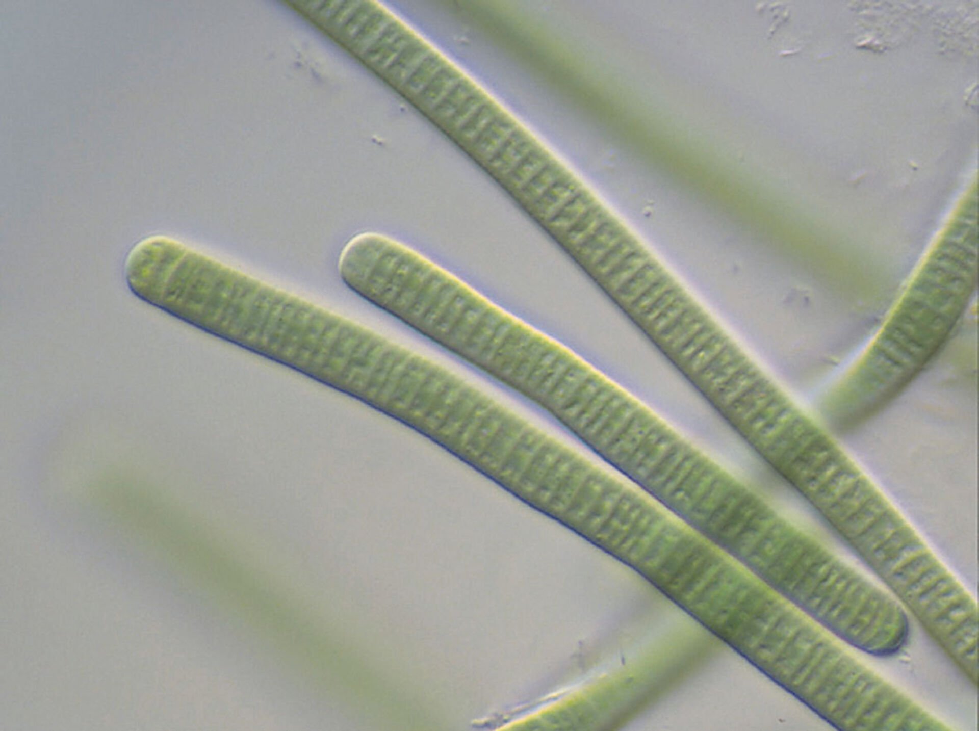  Planktothrix rubescens – diese Alge macht den Hallwilerseefischen momentan das Leben schwer.  